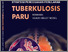[thumbnail of Strategi Pencegahan Penularan Tuberkulosis Paru Berbasis Health Belief Model]